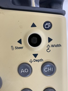 超音波診断装置｜LOGIQ S7 Expert｜GEヘルスケアの写真6枚目