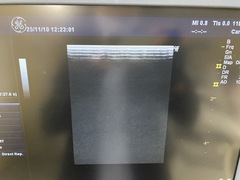 超音波診断装置（カラードプラ）｜LOGIQ P6｜GEヘルスケアの写真6枚目