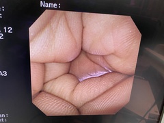 Video Gastroscope｜GIF-XP260NS｜Olympus Medical Systems photo6