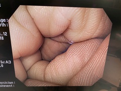 Video Gastroscope｜GIF-Q240｜Olympus Medical Systems photo6