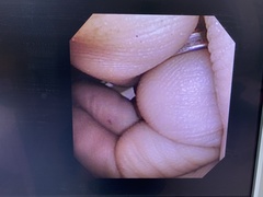 ventriculovideoscope｜VEF TYPE V｜Olympus Medical Systems photo6