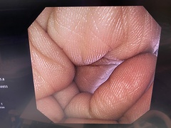 Video Gastroscope｜GIF-XP290N｜Olympus Medical Systems photo6