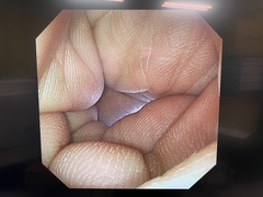 Video Gastroscope｜GIF-XP290N｜Olympus Medical Systems photo6