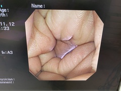 上部消化管汎用ビデオスコープ｜GIF-XP260NS｜オリンパスメディカルシステムズ株式会社の写真6枚目