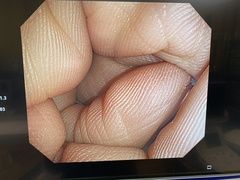 Video Colonoscope｜PCF-Q260AI｜Olympus Medical Systems photo6