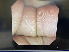 Video Duodenoscope｜JF-240｜Olympus Medical Systems photo6