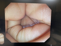 上部消化管汎用ビデオスコープ｜GIF-Q260J｜オリンパスメディカルシステムズ株式会社の写真6枚目