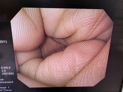 上部消化管汎用ビデオスコープ｜GIF-H290｜オリンパスメディカルシステムズ株式会社の写真6枚目