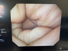 Video Gastroscope｜GIF-Q260｜Olympus Medical Systems photo6