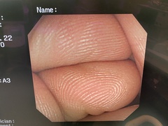 Video Duodenoscope｜JF-240｜Olympus Medical Systems photo6