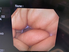 上部消化管汎用ビデオスコープ｜GIF-XQ240｜オリンパスメディカルシステムズ株式会社の写真6枚目