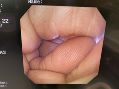 上部消化管汎用ビデオスコープ｜GIF-XQ240｜オリンパスメディカルシステムズ株式会社の写真6枚目