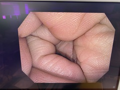 Video Colonoscope｜PCF-H170I｜Olympus Medical Systems photo6