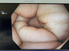 Video Gastroscope｜GIF-EZ1500｜Olympus Medical Systems photo6