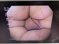 Video Gastroscope｜GIF-Q150X｜Olympus Medical Systems photo6