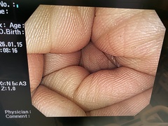 Video Colonoscope｜CF-H260AZI｜Olympus Medical Systems photo6