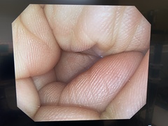 Video Gastroscope｜GIF-Q240Z｜Olympus Medical Systems photo6