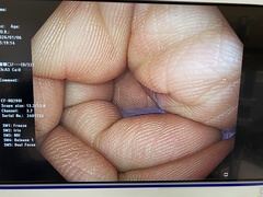 Video Colonoscope｜CF-HQ290I｜Olympus Medical Systems photo6