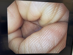 上部消化管汎用ビデオスコープ｜GIF-H290｜オリンパスメディカルシステムズ株式会社の写真6枚目