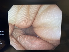 Video Gastroscope｜GIF-H260Z｜Olympus Medical Systems photo6