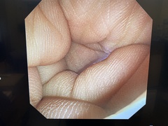 Video Transnasal Gastroscope｜GIF-N260｜Olympus Medical Systems photo6