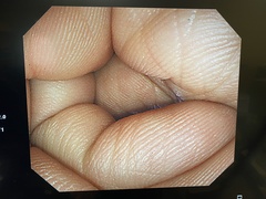 Video Colonoscope｜CF-Q260AI｜Olympus Medical Systems photo6