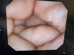 大腸ビデオスコープ｜CF-Q260AI｜オリンパスメディカルシステムズ株式会社の写真6枚目