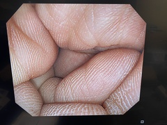 Video Colonoscope｜CF-Q260AI｜Olympus Medical Systems photo6