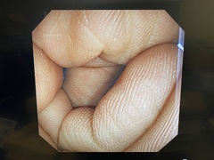 Video Colonoscope｜CF-240AI｜Olympus Medical Systems photo6