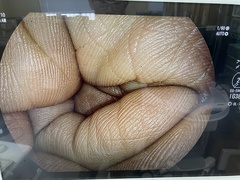 上部消化管汎用スコープ｜EG-590WR2｜富士フイルムメディカルの写真6枚目