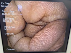 上部消化管汎用ビデオスコープ｜GIF-Q150X｜オリンパスメディカルシステムズ株式会社の写真6枚目