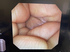 Video Gastroscope｜GIF-XP260NS｜Olympus Medical Systems photo6