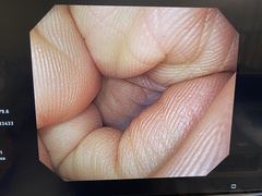 Video Gastroscope｜GIF-H290Z｜Olympus Medical Systems photo6