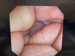 Video Colonoscope｜PCF-P240AI｜Olympus Medical Systems photo6