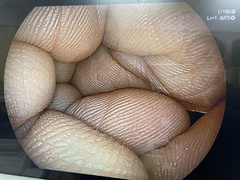 Video Transnasal Gastroscope｜EG-6400N｜Fujifilm Medical photo6