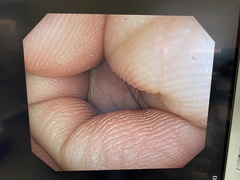 Video Colonoscope｜PCF-Q260AZI｜Olympus Medical Systems photo6