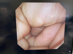 Video Gastroscope｜GIF-XP260NS｜Olympus Medical Systems photo6