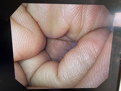 Video Gastroscope｜GIF-H290｜Olympus Medical Systems photo6