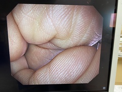 ｜GIF-1200N｜Olympus Medical Systems photo6