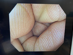 大腸ビデオスコープ｜PCF-H290I｜オリンパスメディカルシステムズ株式会社の写真6枚目