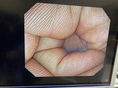 Video Colonoscope｜PCF-Q260AI｜Olympus Medical Systems photo6