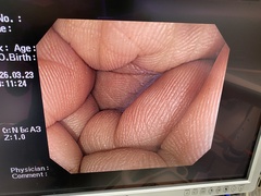 Video Colonoscope｜CF-H260AZI｜Olympus Medical Systems photo6