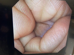 Video Gastroscope｜GIF-XP290N｜Olympus Medical Systems photo6