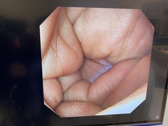 Video Gastroscope｜GIF-XP290N｜Olympus Medical Systems photo6