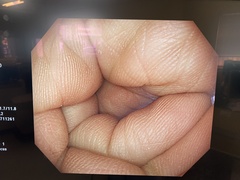 大腸ビデオスコープ｜PCF-H290ZI｜オリンパスメディカルシステムズ株式会社の写真6枚目