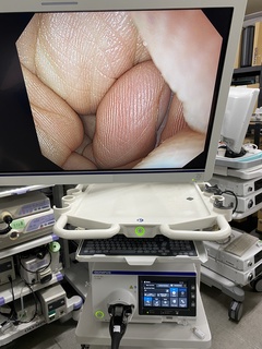 上部消化管汎用ビデオスコープ（経鼻）｜GIF-1200N｜オリンパスメディカルシステムズ株式会社の写真6枚目