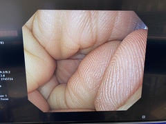 上部消化管汎用ビデオスコープ｜GIF-Q260｜オリンパスメディカルシステムズ株式会社の写真6枚目