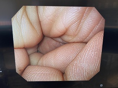 Video Gastroscope｜GIF-Q240｜Olympus Medical Systems photo6