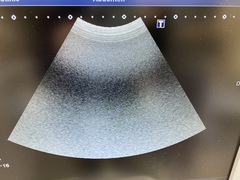 Ultrasound System(Color)｜Xario100 TUS-X100｜Canon Medical Systems photo6