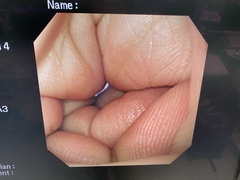 Video Gastroscope｜GIF-XQ240｜Olympus Medical Systems photo6